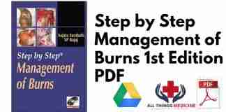 Step by Step Management of Burns 1st Edition PDF