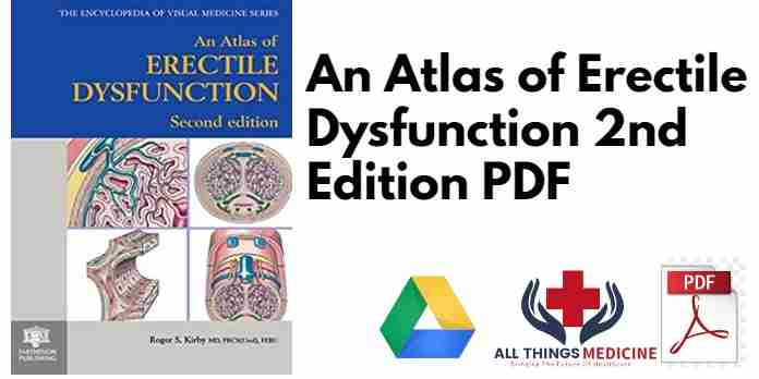 An Atlas of Erectile Dysfunction 2nd Edition PDF