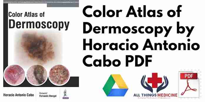 Color Atlas of Dermoscopy by Horacio Antonio Cabo PDF