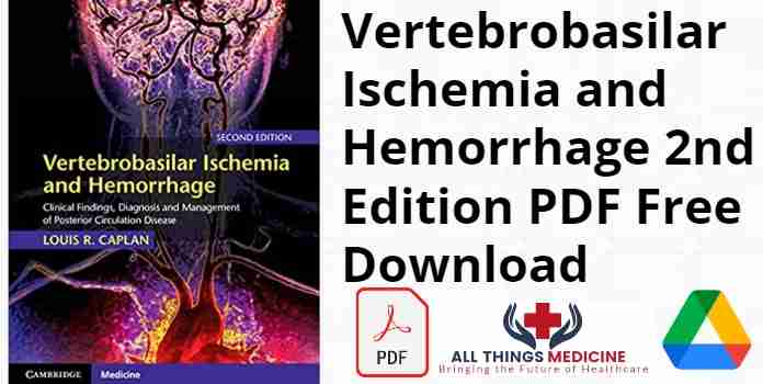 Vertebrobasilar Ischemia and Hemorrhage 2nd Edition PDF
