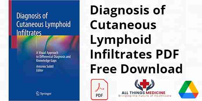 Diagnosis of Cutaneous Lymphoid Infiltrates PDF