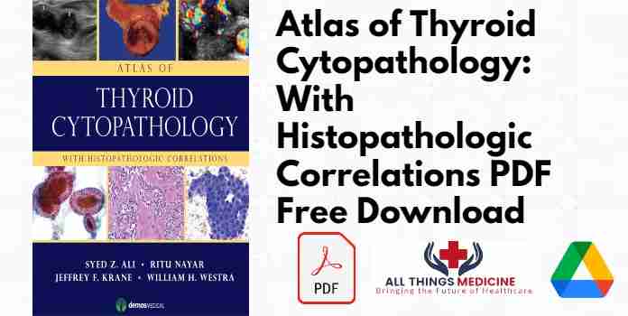 Atlas of Thyroid Cytopathology: With Histopathologic Correlations PDF