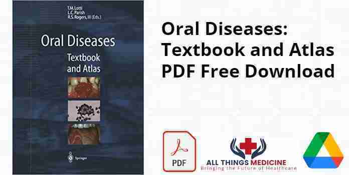 Oral Diseases: Textbook and Atlas PDF