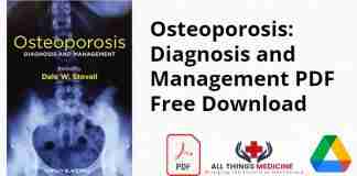 Osteoporosis: Diagnosis and Management PDF