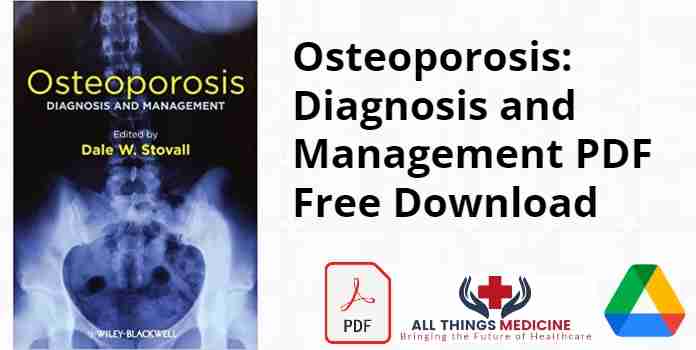 Osteoporosis: Diagnosis and Management PDF