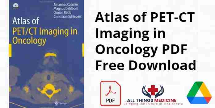 Atlas of PET-CT Imaging in Oncology PDF