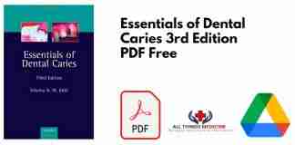 Essentials of Dental Caries 3rd Edition PDF
