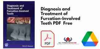 Diagnosis and Treatment of Furcation-Involved Teeth PDF