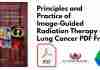 Principles and Practice of Image-Guided Radiation Therapy of Lung Cancer PDF