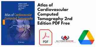 Atlas of Cardiovascular Computed Tomography 2nd Edition