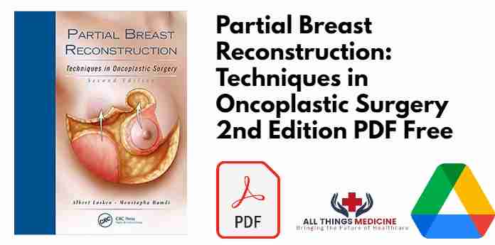 Partial Breast Reconstruction: Techniques in Oncoplastic Surgery 2nd Edition PDF