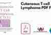 Cutaneous T-cell Lymphoma PDF