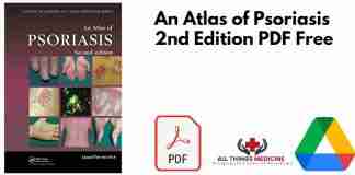 An Atlas of Psoriasis 2nd Edition PDF