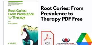 Root Caries: From Prevalence to Therapy PDF