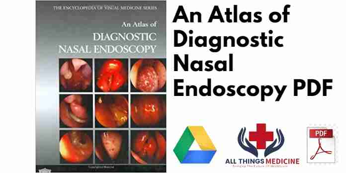 An Atlas of Diagnostic Nasal Endoscopy PDF