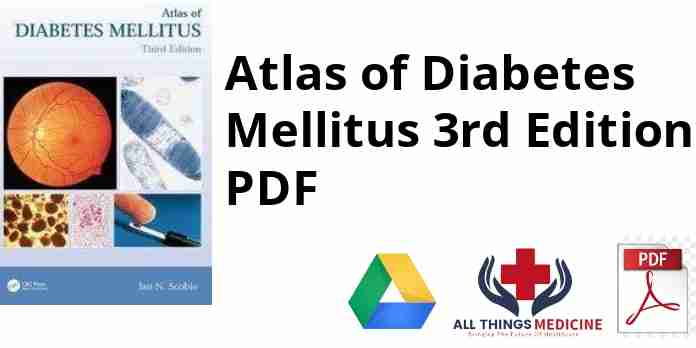 Atlas of Diabetes Mellitus 3rd Edition PDF