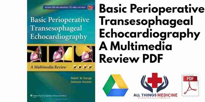 Basic Perioperative Transesophageal Echocardiography A Multimedia Review PDF