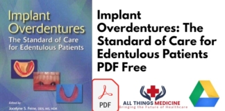 Implant Overdentures by Jocelyne Feine PDF