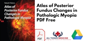 Atlas of Posterior Fundus Changes in Pathologic Myopia PDF