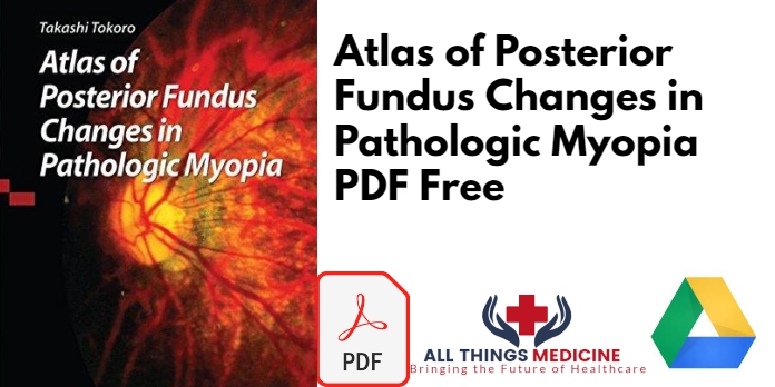 Atlas of Posterior Fundus Changes in Pathologic Myopia PDF
