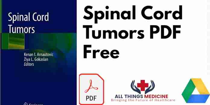 Spinal Cord Tumors PDF