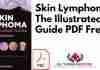 Skin Lymphoma PDF