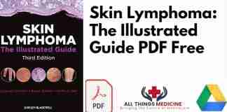 Skin Lymphoma PDF