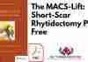 The MACS Lift: Short Scar Rhytidectomy PDF