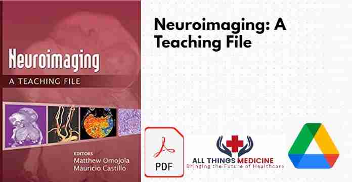 Neuroimaging A Teaching File PDF