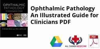 Ophthalmic Pathology An Illustrated Guide for Clinicians PDF