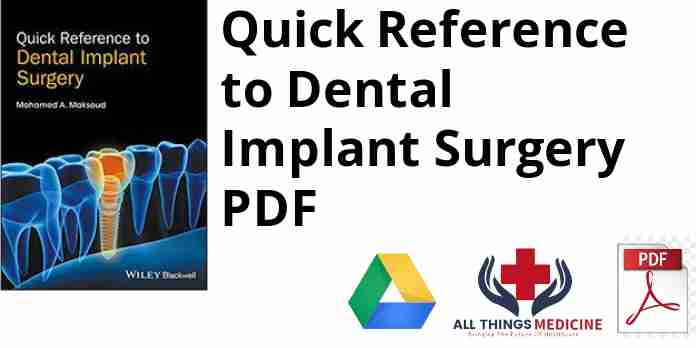Quick Reference to Dental Implant Surgery PDF