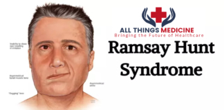 Ramsay-Hunt-Syndrome 1