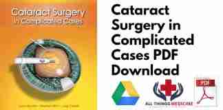 Cataract Surgery in Complicated Cases PDF