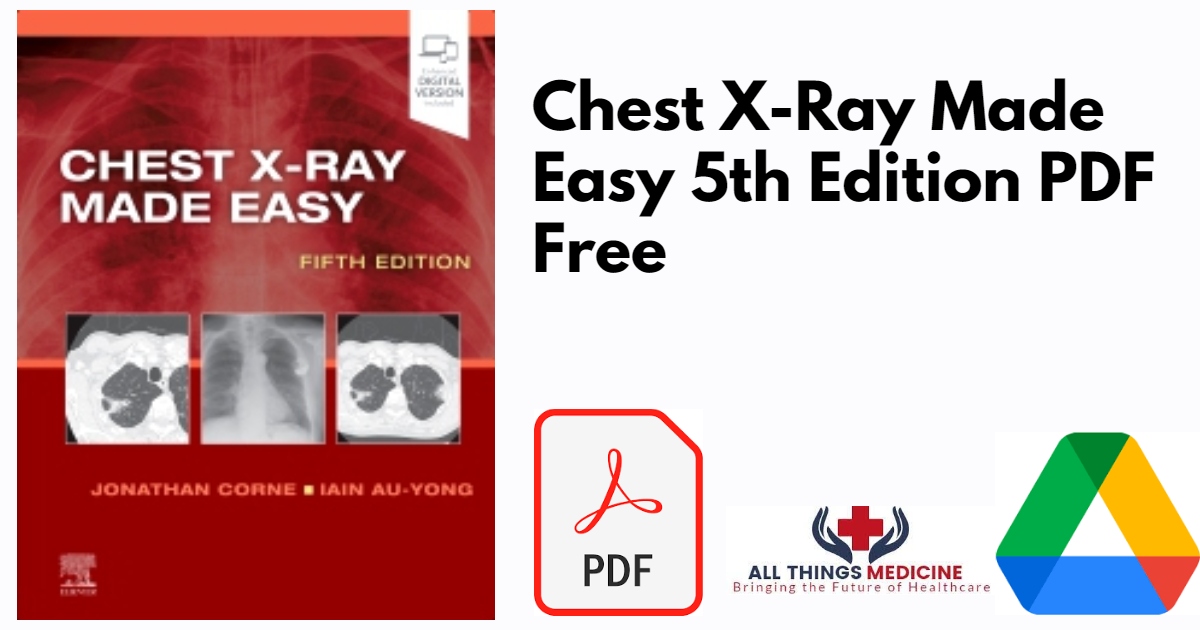 Chest X-Ray Made Easy 5th Edition PDF