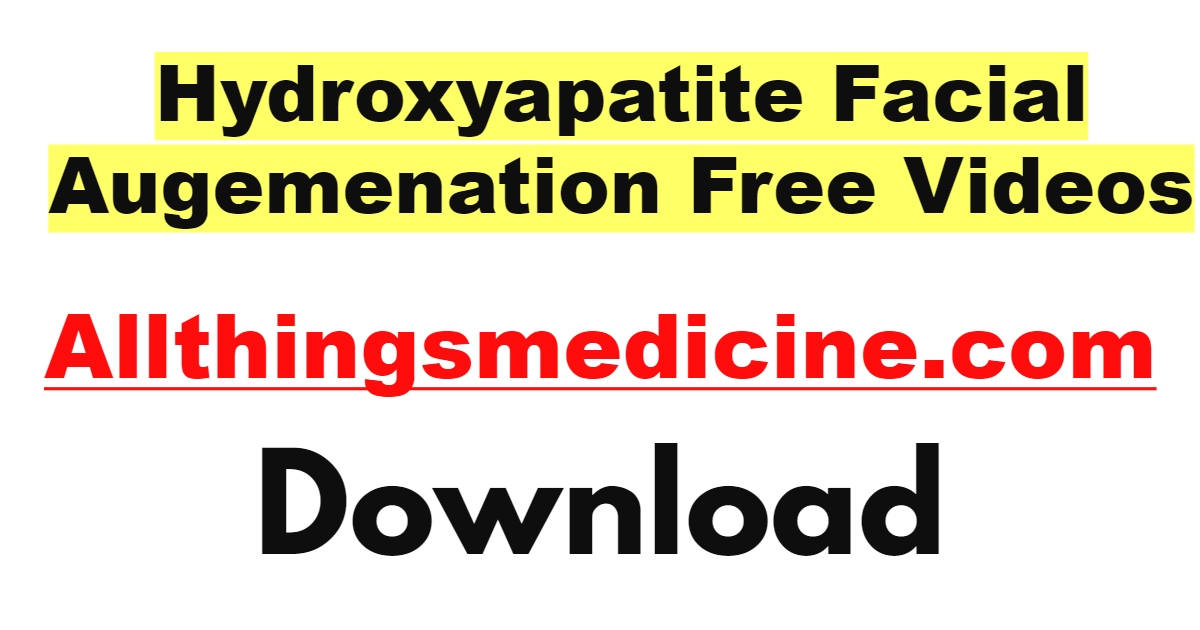 hydroxyapatite-facial-augemenation-videos-free-download