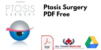 Ptosis Surgery by Arnab Biswas PDF