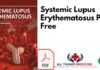 Systemic Lupus Erythematosus PDF