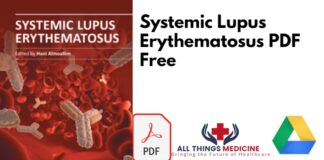 Systemic Lupus Erythematosus PDF