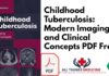 Childhood Tuberculosis by Douglas Jamieson PDF