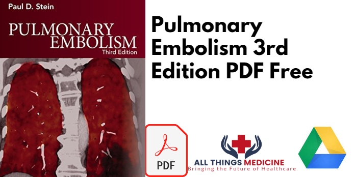 Pulmonary Embolism 3rd Edition PDF