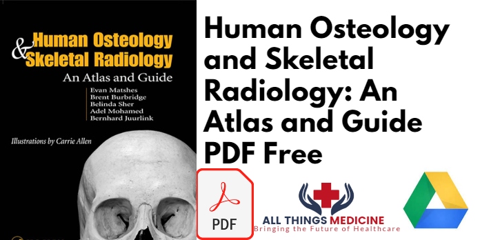 Human Osteology and Skeletal Radiology: An Atlas and Guide PDF Free