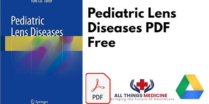 Pediatric Lens Diseases PDF