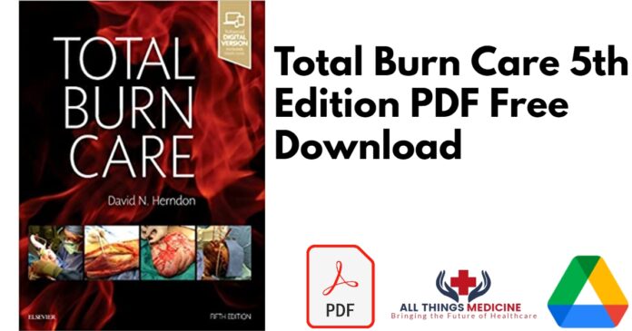 Total Burn Care 5th Edition PDF
