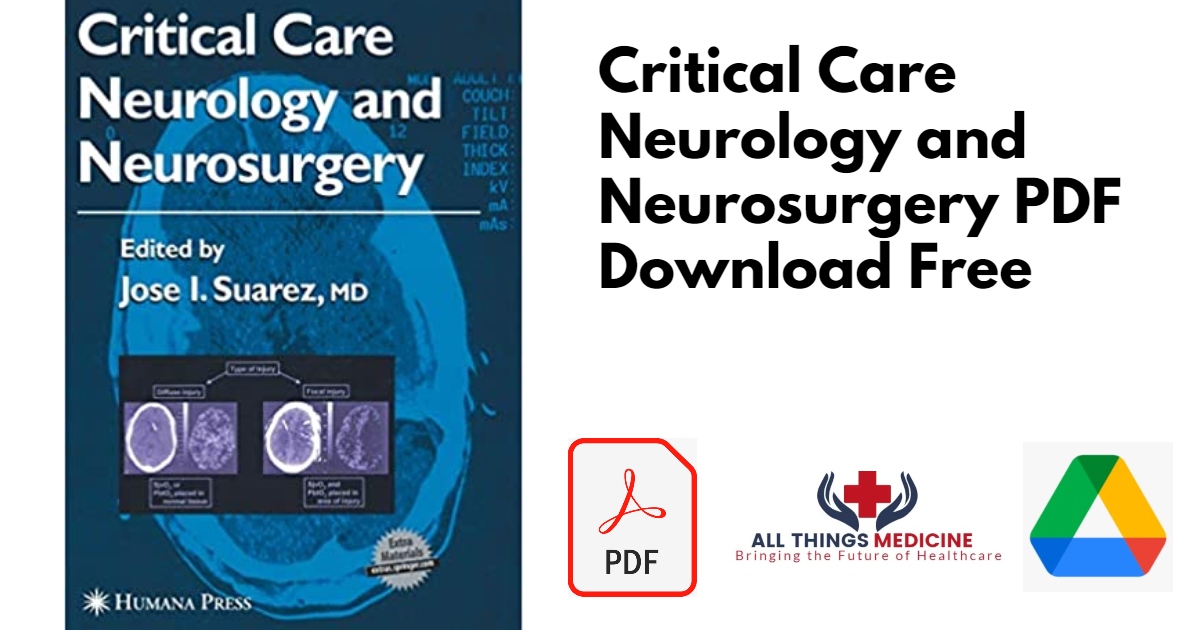 Critical Care Neurology and Neurosurgery PDF