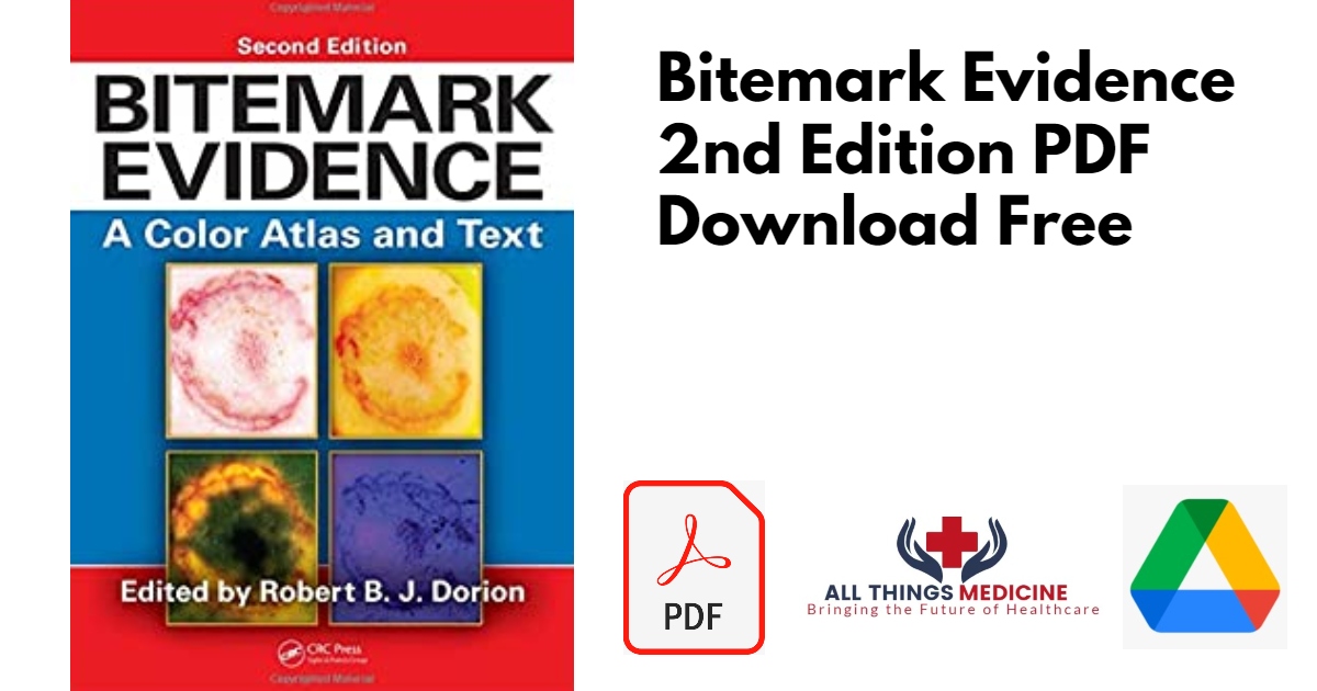 Bitemark Evidence 2nd Edition PDF