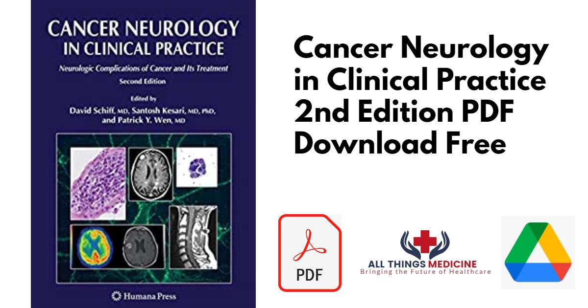 Cancer Neurology in Clinical Practice 2nd Edition PDF