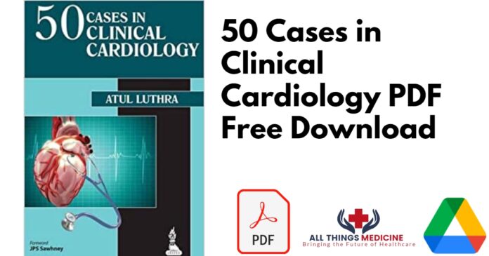 50 Cases in Clinical Cardiology PDF