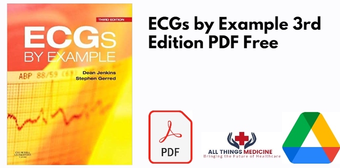 ECGs by Example 3rd Edition PDF