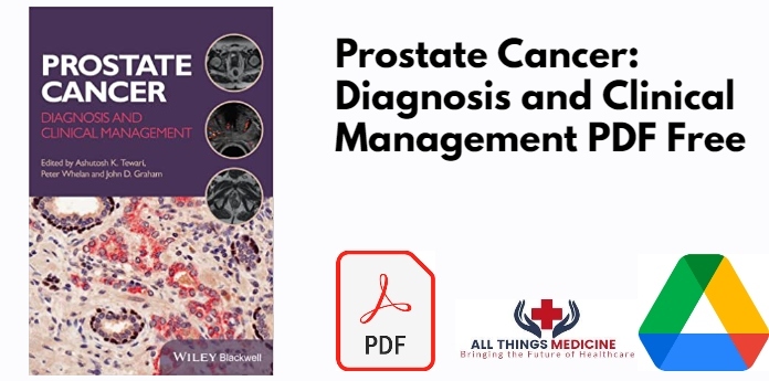Prostate Cancer: Diagnosis and Clinical Management PDF