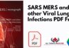 SARS MERS and other Viral Lung Infections PDF